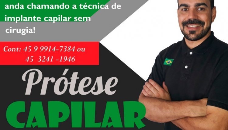 Salão Ideal se destaca como referência na aplicação de prótese capilar