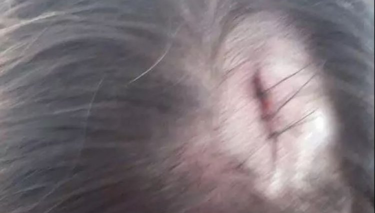 Homem é agredido pela ex-mulher com uma garrafa na cabeça em Cafelândia 