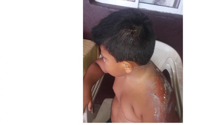 Mãe acusa médico de negligência em Cafelândia, após filho sofrer hemorragia
