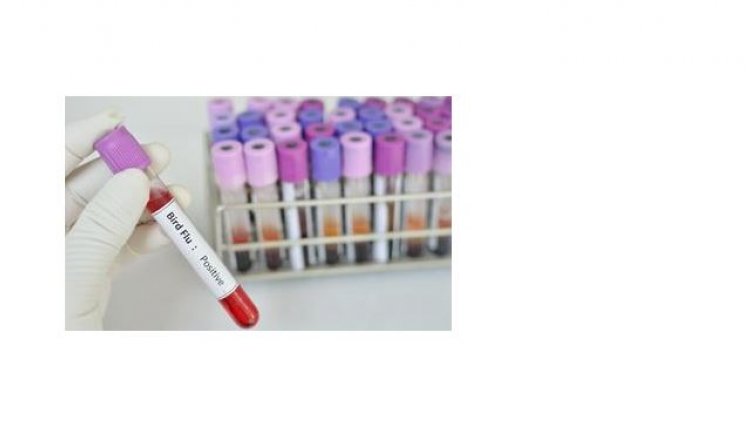 China confirma caso de influenza aviária H5N6 em aves selvagens