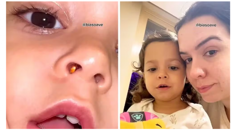 Pecinha de brinquedo vai parar dentro do nariz de menina: "Desespero", diz mãe; especialista explica o que fazer