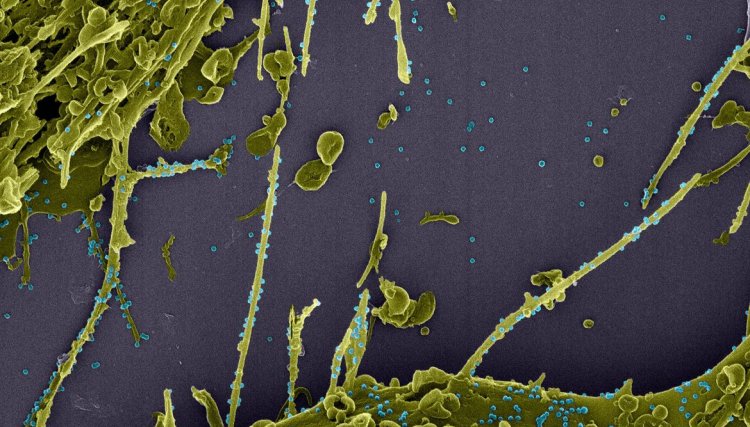 Estudo constata infecção simultânea por duas linhagens do coronavírus