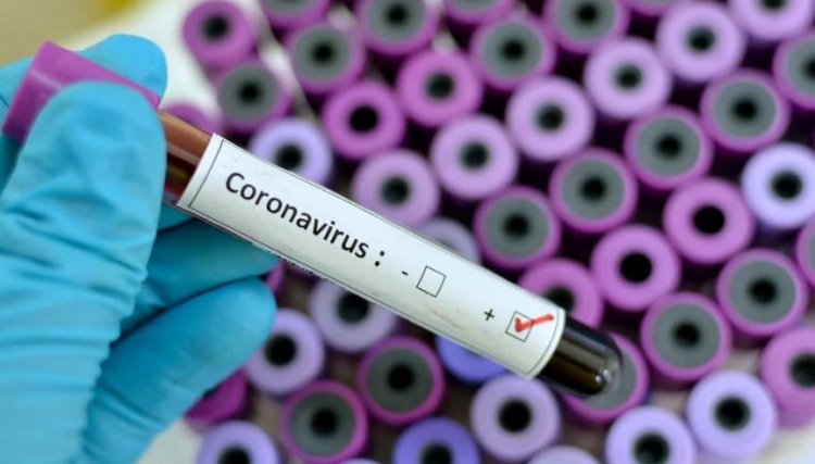Cafelândia confirma dois casos de Covid-19