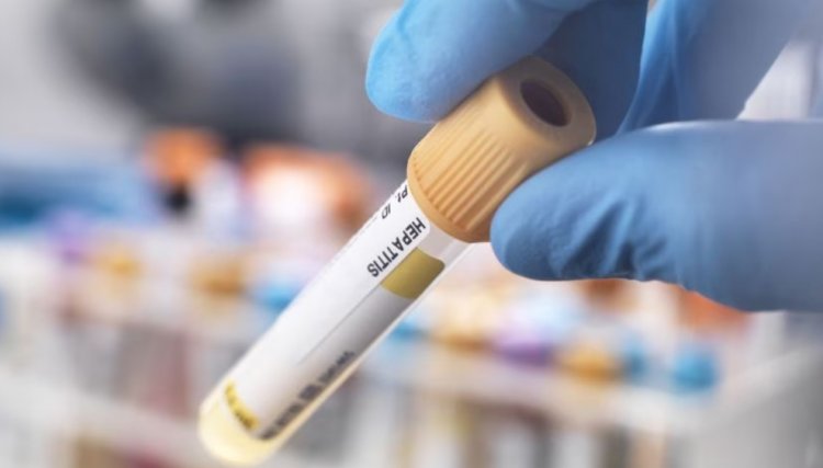 Saúde investiga nove casos de hepatite aguda infantil no Brasil, três no Paraná