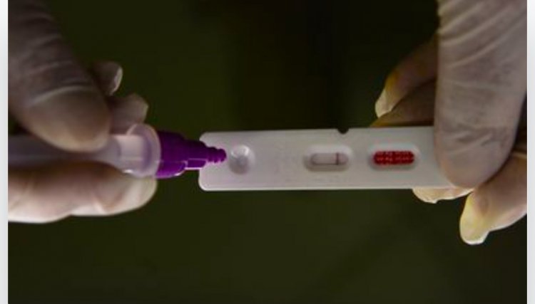 Pesquisadores identificam método capaz de prever gravidade da covid-19