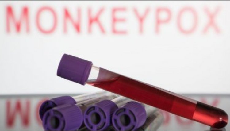 Cascavel confirma primeiro caso de Monkeypox - Varíola dos Macacos