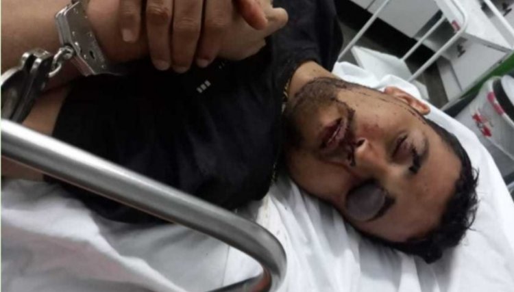 Vereador que foi preso roubando gado em fazenda de MT n&atilde;o resiste aos ferimentos e tem morte anunciada