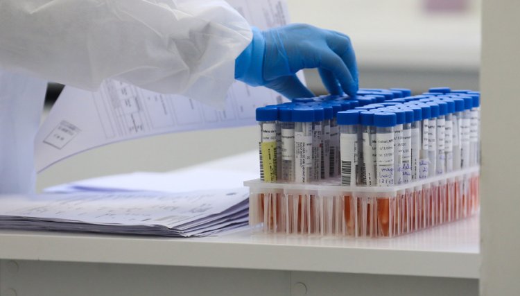 Casos de Covid-19 sobem 60% em uma semana e óbitos caem 23% no Paraná 
