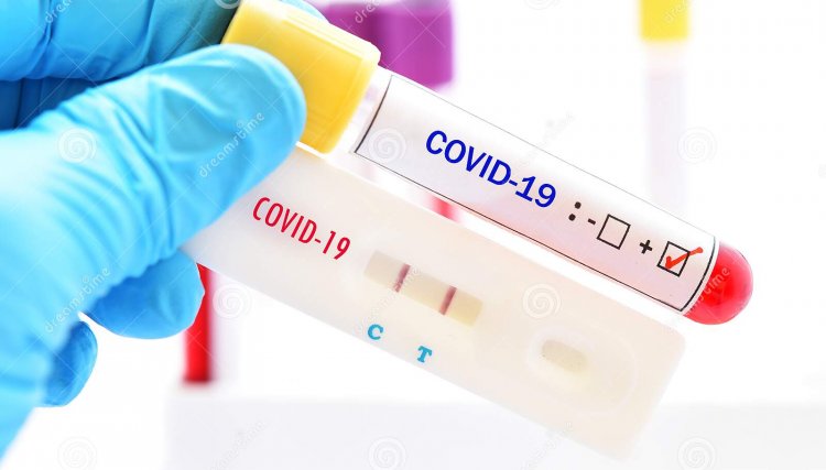 11 novos casos de Covid-19 são confirmados em Assis chateaubriand