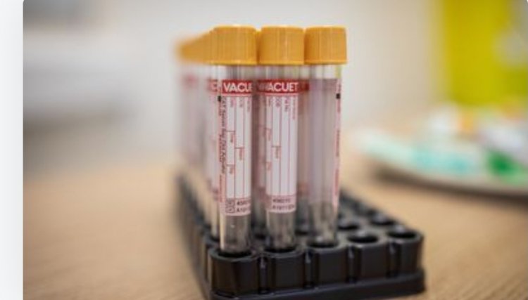 Brasil registra 552 óbitos e 30.476 novos casos de Covid apenas hoje 