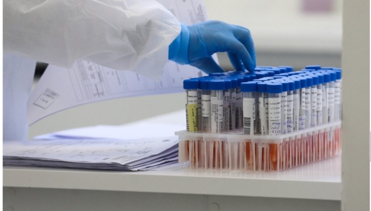 Julho foi o mês que concentrou os piores indicadores de casos e de óbitos por Covid-19 no PR