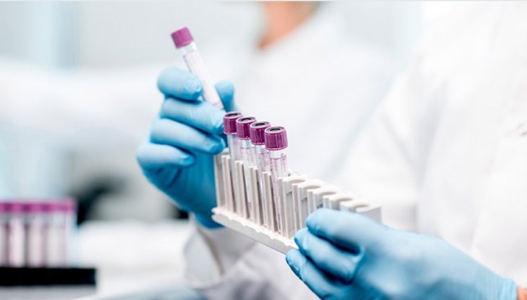 Johnson & Johnson inclui Paraná em fase final de testes paral vacina contra Covid-19