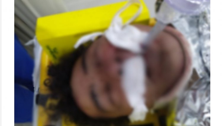 Homem é espancado em Nova Aurora e sofre traumatismo craniano 