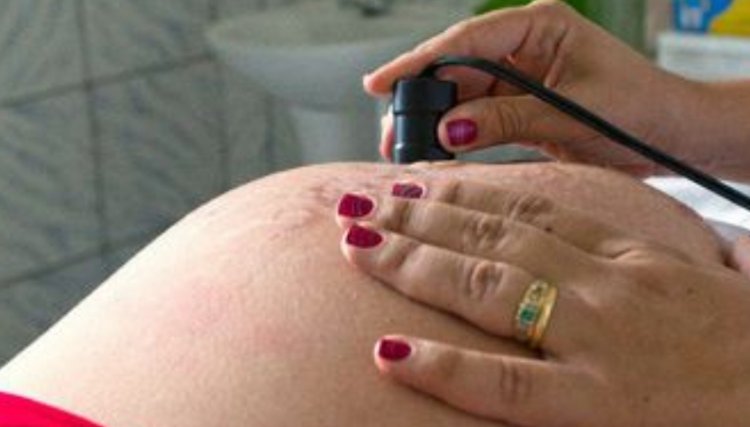 Covid-19: mortalidade de gestantes é mais que o dobro da média no país