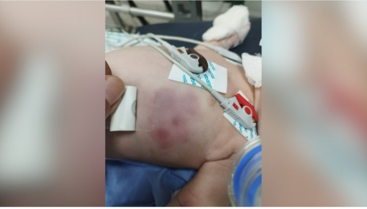 Recém-nascido segue internado em estado grave após ser violentado pelos pais 