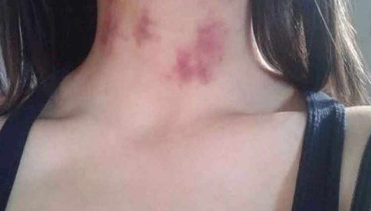 Após caminhada, mulher casada volta toda chupada pra casa e diz que foi  A NUVEM de Gafanhoto
