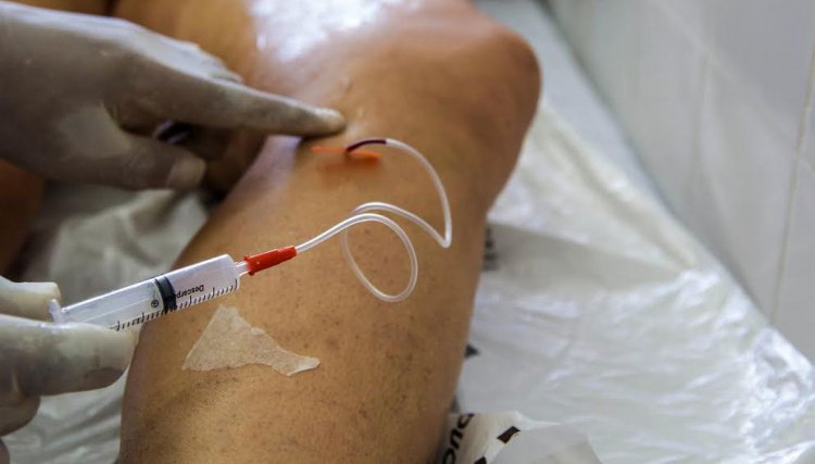 Doença venosa crônica é fator de risco para problemas cardiovasculares